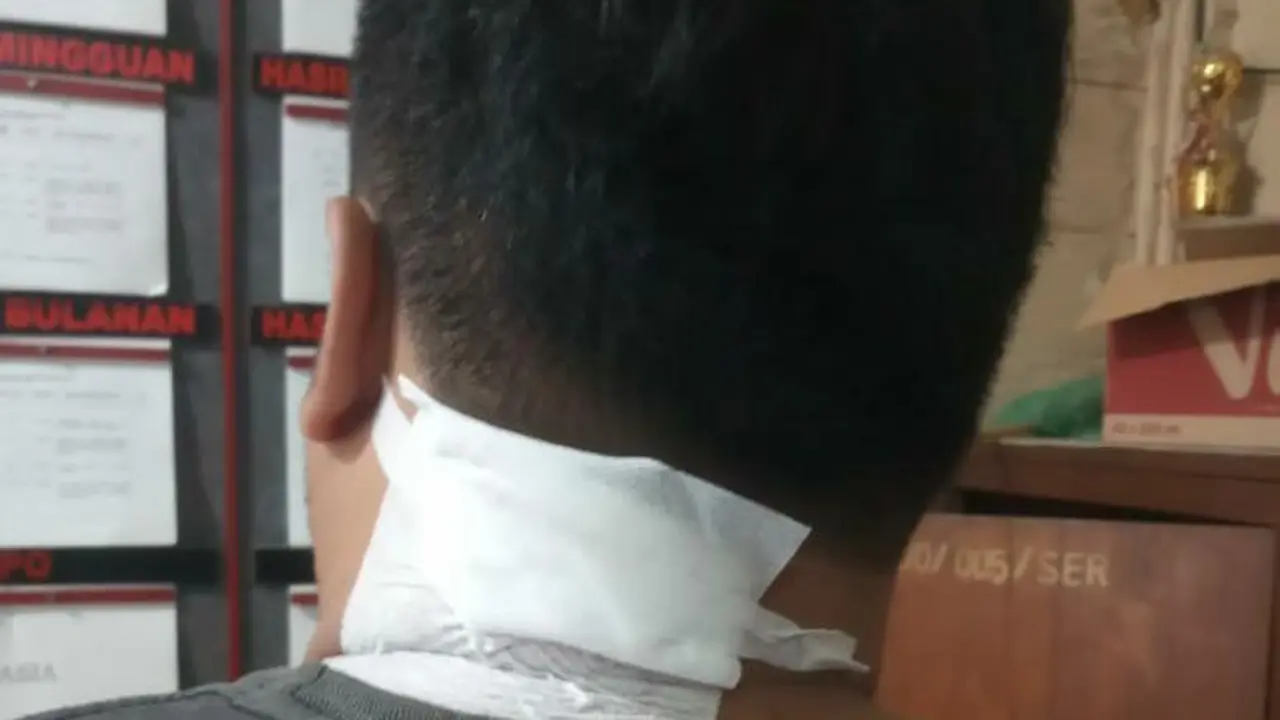 Leher Bagian Belakang Ag Diperban Usai Dibacok 'Gendruwo' (Liputan6.com/Ahmad Adirin)