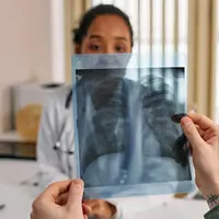 Radang Paru-Paru Bisa Berbahaya, Kenali Gejala Awalnya!