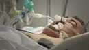 Seorang pasien diintubasi di bagian ICU COVID-19 rumah sakit University Clinical Center di Banja Luka, 4 November 2021. Para dokter di Bosnia bersiap menghadapi ancaman gelombang baru corona di negara yang menjadi salah satu paling terpukul di Eropa pada periode pandemi sebelumnya itu. (AP Photo)