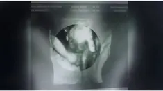Wanita asal Kansas ini menyiapkan dua nama untuk anak kembarnya tersebut, yakni Mason dan Madilyn.