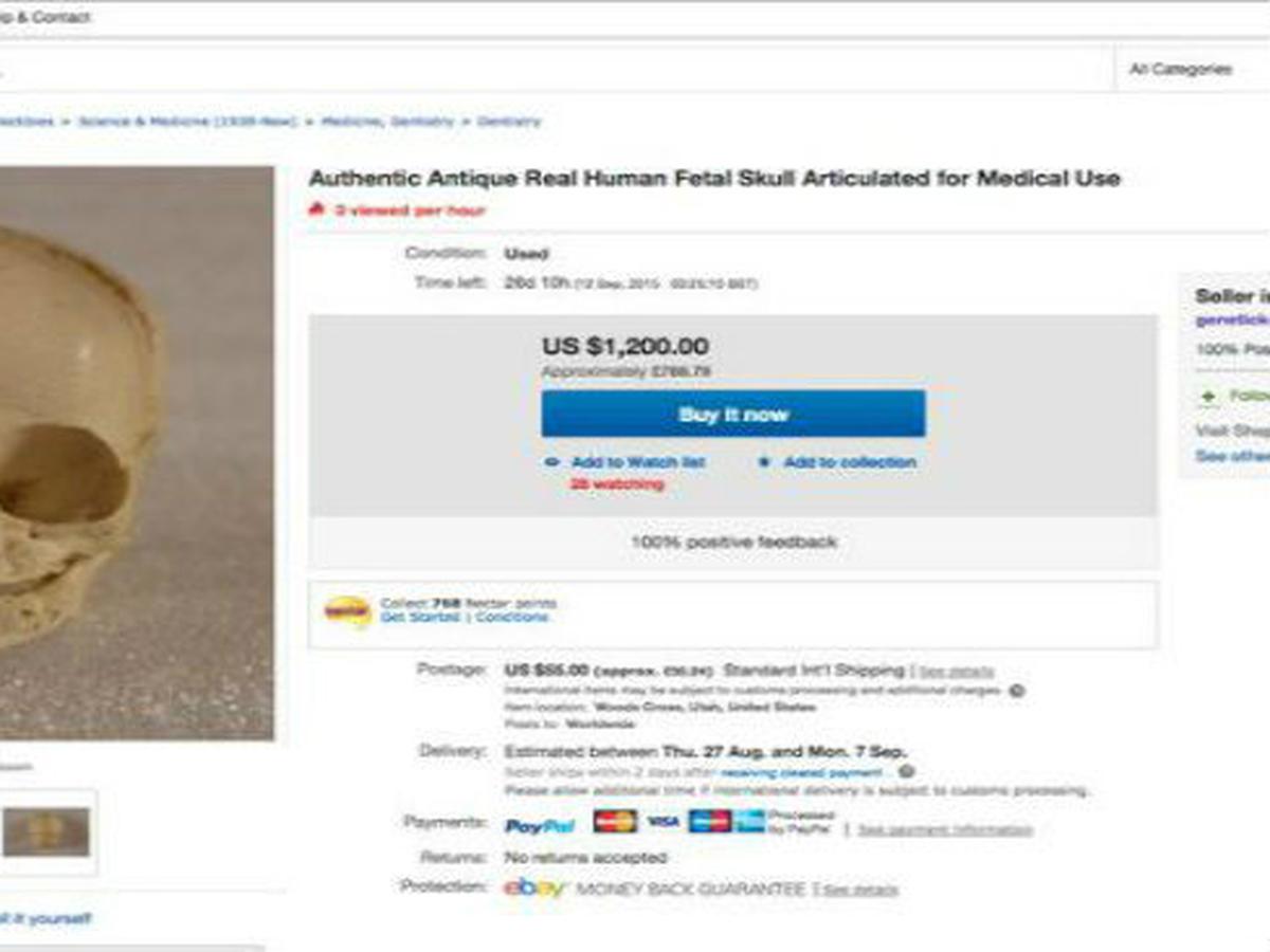 Iklan Jual-Beli Organ Tubuh Manusia Muncul di eBay - Global ...