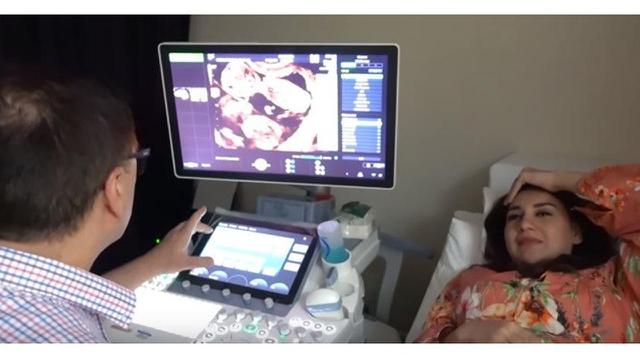 Bayi Kembarnya Meninggal, Ini 7 Momen Kenangan Kehamilan Irish Bella