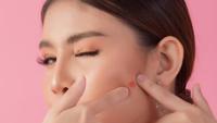 Pakai Pimple Patch tapi Jerawat Tak Sembuh? Ini 5 Kesalahan yang Sering Terjadi