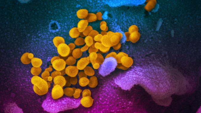 Gambar menggunakan mikroskop elektron yang tak bertanggal pada Februari 2020 menunjukkan virus corona SARS-CoV-2 (kuning) muncul dari permukaan sel (biru/pink) yang dikultur di laboratorium.  Sampel virus dan sel diambil dari seorang pasien yang terinfeksi COVID-19. (NIAID-RML via AP)