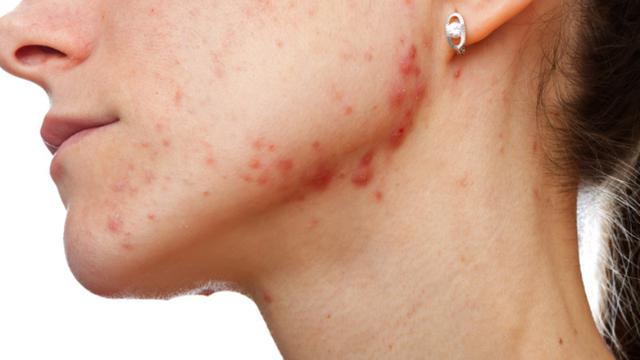 Masalah Kesehatan, 7 Perubahan pada Tubuh Anda Ini Harus Diperhatikan