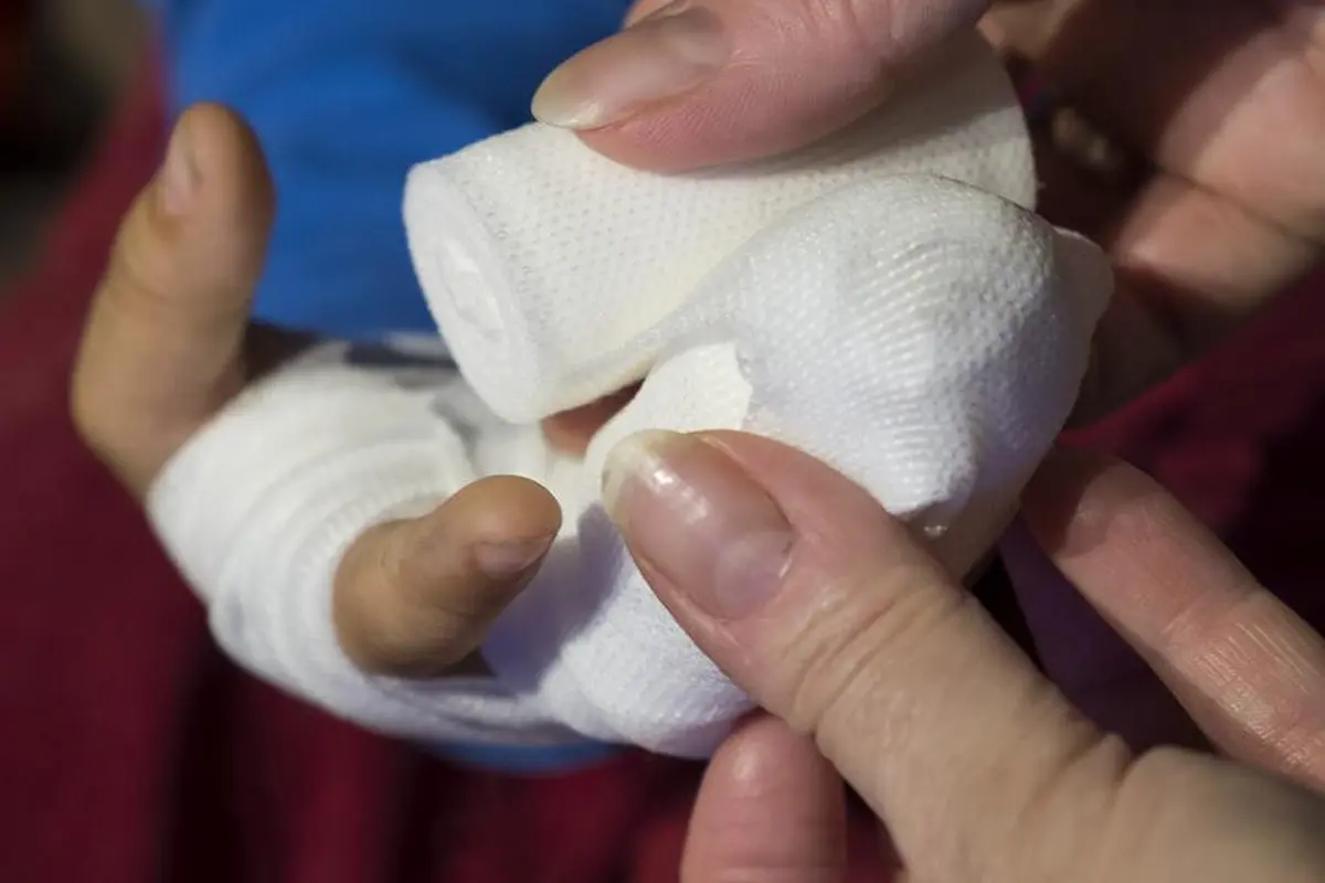 6 Cara Menangani Luka pada Anak Menurut Dokter Spesialis Anak Mesty Ariotedjo