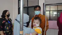 Penyebab Bibir Sumbing Belum Diketahui Pasti, Dokter: Tidak Selalu karena Genetik