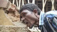 Seorang pria di India berusia Pakkirappa Hunagundi mengatakan mengalami gangguan makan. Dia hanya bisa makan batu bata, kerikil, dan lumpur