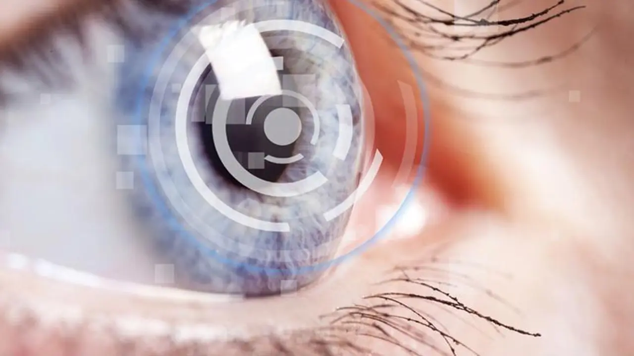 Baca Ini Sebelum Memutuskan untuk Operasi LASIK