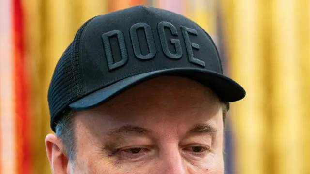 Mata Elon Musk tampak lebam saat dia bertemu Presiden Donald Trump di Gedung Putih, Jumat (30/5/2025).
