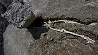 Kerangka manusia yang kepalanya putus oleh hantaman benda serupa batu saat letusan Vesuvius (AFP)