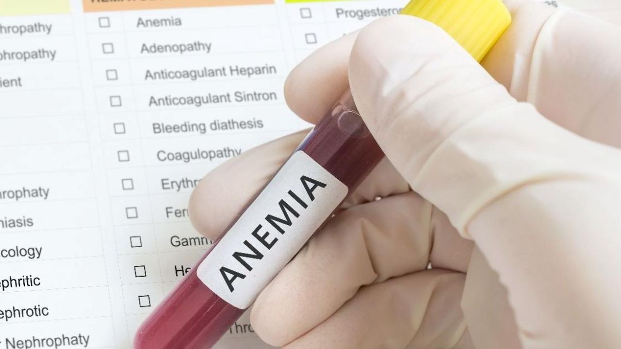 Kenali Apa Itu Anemia Aplastik, Faktor Risiko, Serta Gejalanya