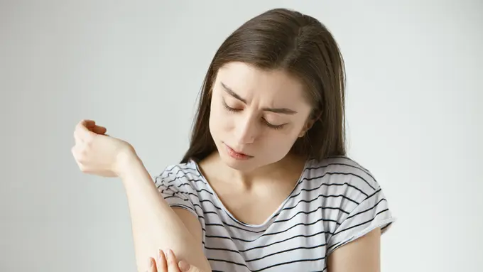 Mengapa Anak Bisa Terkena Panu? Ini Cara Mengobatinya dengan Tepat