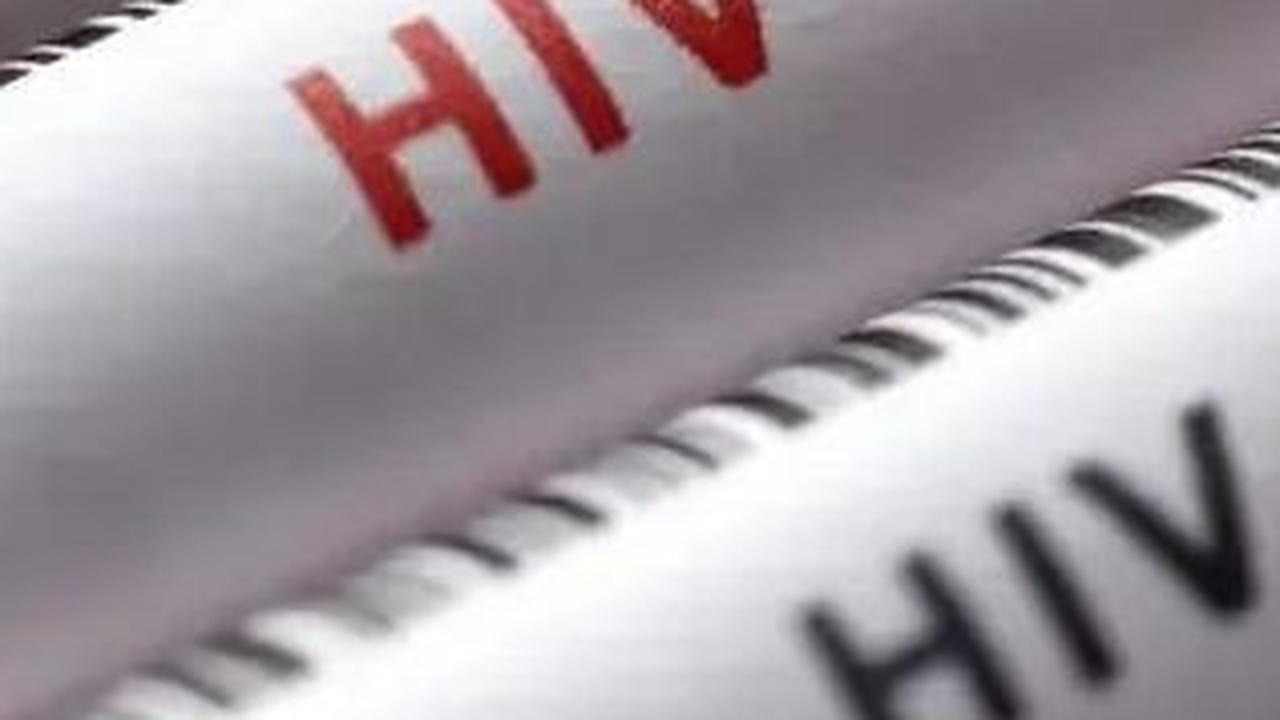 Hal yang Perlu Diperhatikan Sebelum Memulai Pengobatan HIV
