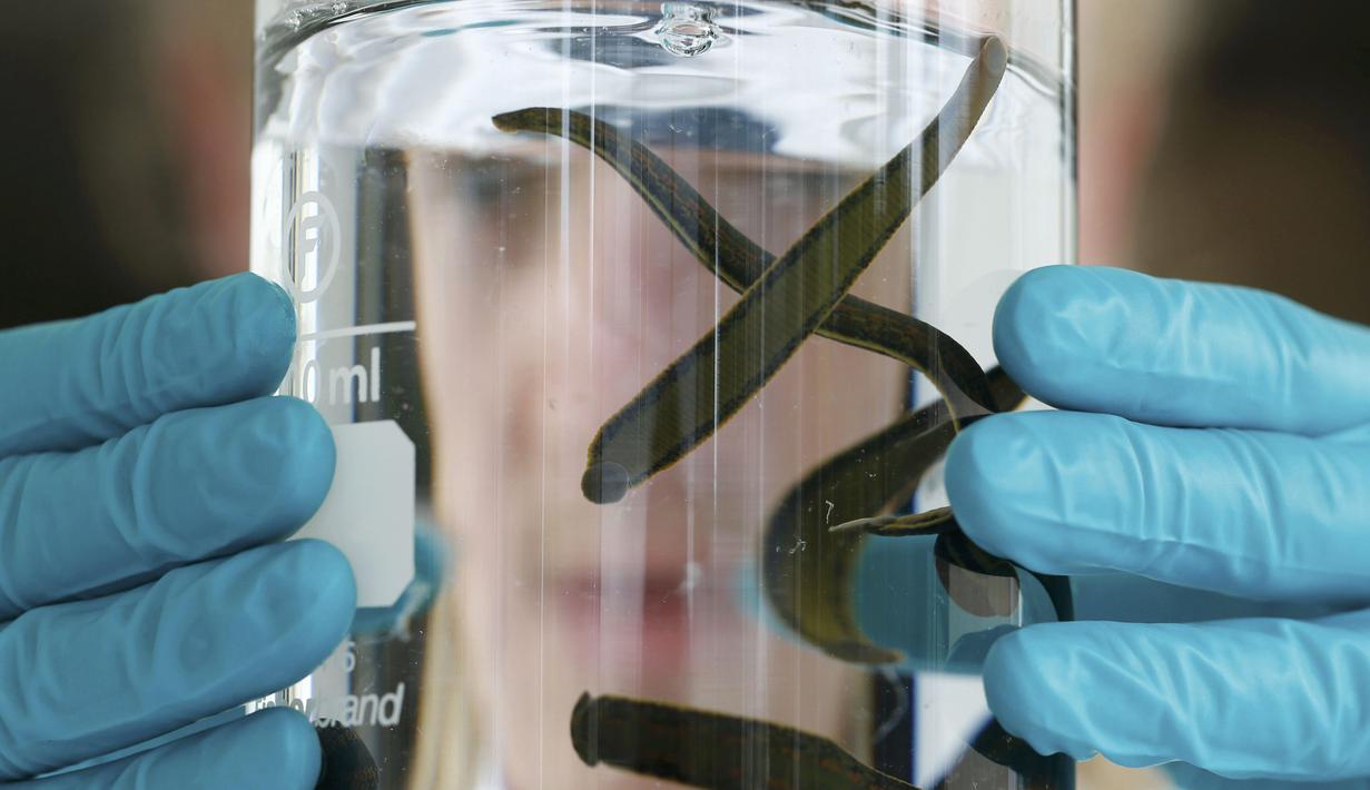 Dokter menunjukkan lintah jenis Hirudo Medicinalis yang digunakan untuk terapi, Prancis, (23/11). Lintah ini mampu mengeluarkan air liur yang mengandung lebih dari 60 jenis protein saat mengisap darah. (REUTERS / Regis Duvignau)
