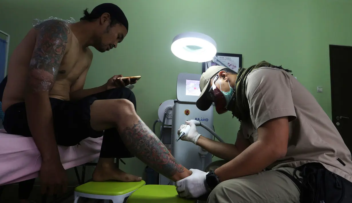 Petugas klinik menembakan laser untuk menghapus tato di tubuh seorang pria bernama Taufiq Hidayat di Tangerang (9/8). Hapus tato ini gratis dengan syarat pasien harus membaca dan belajar Alquran Surat Arrahman. (AP Photo/Achmad Ibrahim)