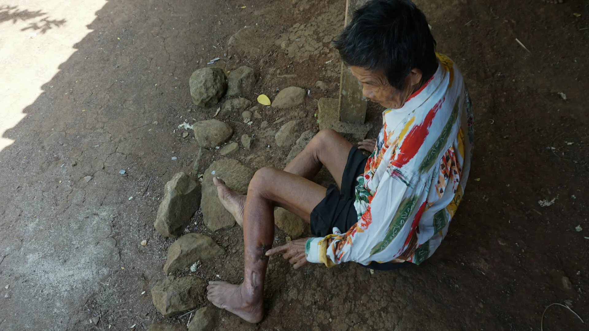 Samin, salah satu korban serangan monyet di Karanggede, Boyolali sedang menunjukkan bekas luka serangan monyet. Kakek berusia 75 tahun dua kali serangan dalam kurun waktu satu tahun, Rabu (9/8).(Liputan6.com/Fajar Abrori)