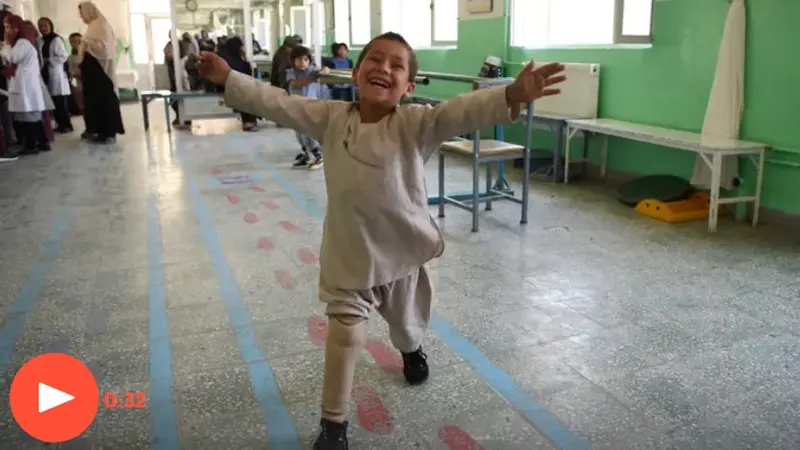 Viral video bocah menari bahagia dapat kaki palsu baru