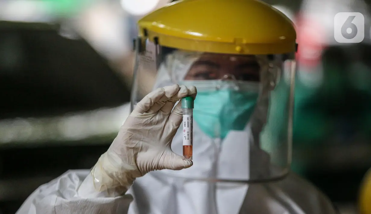 Salah satu sampel saat Swab Test COVID 19 oleh petugas Puskesmas Kecamatan Gambir di kawasan jalan Juanda, Jakarta, Selasa (16/6/2020).  Tes Swab untuk mencari warga positif Covid-19 tanpa gejala ini menyasar petugas PPSU dan para pedagang Pasar Ceylon. (Liputan6.com/Faizal Fanani)