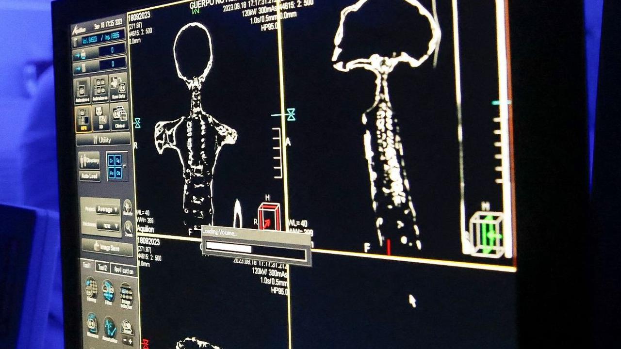 Dari pemeriksaan yang tertuang pada layar monitor didapat penampakan visual yang memperlihatkan kondisi struktur rangka dari mumi alien tersebut.