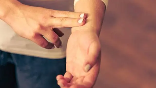 Ilustrasi aritmia jantung.