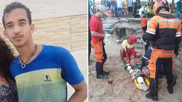 Remaja Tewas Setalah Kehilangan Penis Akibat Gigitan Hiu