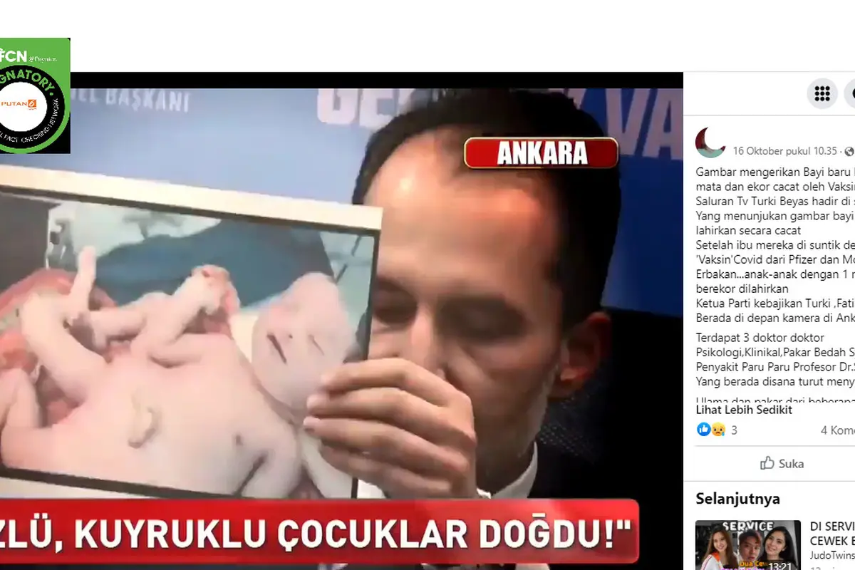 Cek Fakta Liputan6.com menelusuri klaim penampakan bayi satu mata dan berekor akibat ibunya divaksin Covid-19 saat mengandung