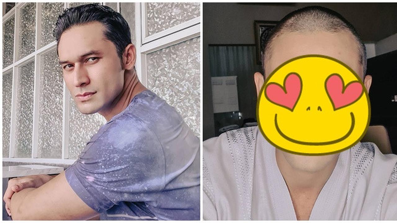 Bikin Pangling, Ini 5 Potret Terbaru Indra Brugman Tampil Botak