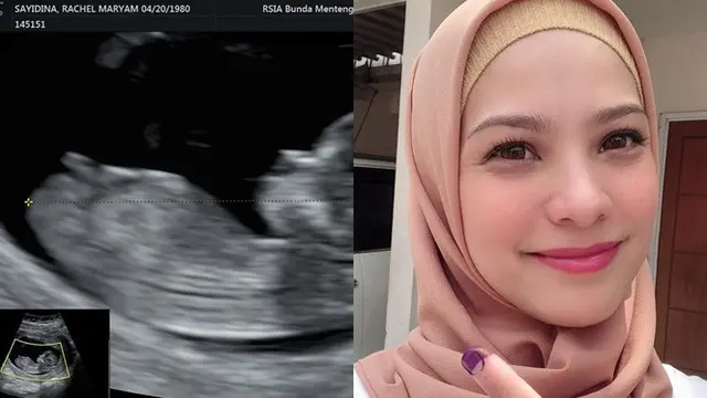 5 Artis yang Umumkan Kehamilan Jelang Ramadan, Terbaru Istri Fedi Nuril (
