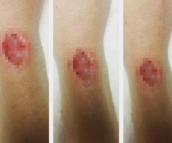 Ngeri Pakai Ikat Rambut Di Lengan Tangan Bisa Bengkak Dan Bernanah Beauty Fimela Com