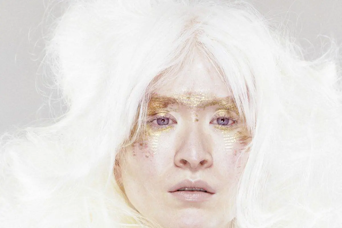 [Fimela] Connie Chiu, model albino yang mengubah perbedaan jadi kelebihan