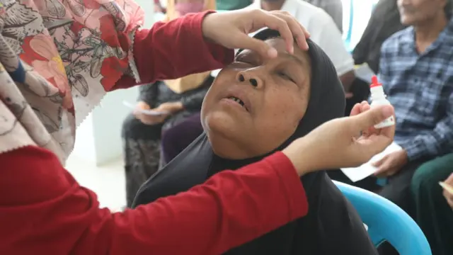 600 Warga Lombok Ikuti Operasi Katarak Gratis untuk Hadang Disabilitas Netra