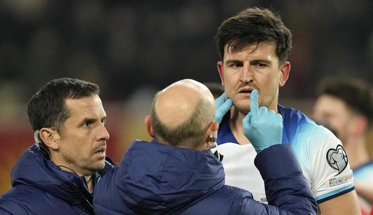 Tim medis memeriksa pemain Inggris, Harry Maguire, setelah terjadi benturan dengan pemain Makedonia Utara dalam duel matchday 10 Kualifikasi Euro 2024 Grup C, Selasa (21/11/2023). (AP Photo/Darko Vojinovic)