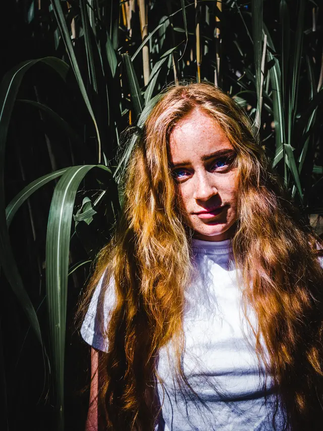 ilustrasi jenis rosacea/unsplash