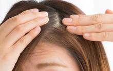Cara Menghitamkan Rambut Beruban Secara Alami dengan Wijen Hitam dan Madu
