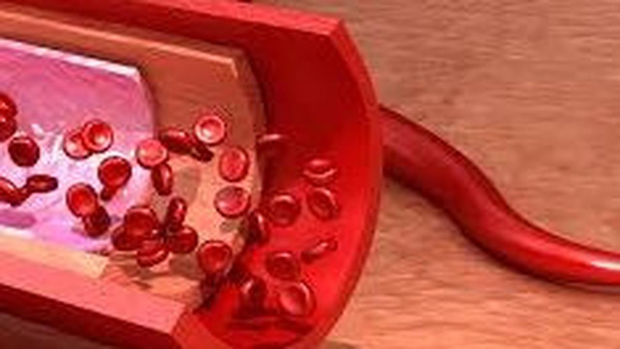 Perbedaan Arteri dan Vena <br>