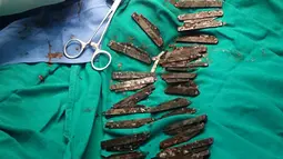 Sejumlah pisau yang berhasil dikeluarkan tim medis dari perut seorang polisi India, Surjeet Singh (42) di sebuah rumah sakit di Amritsar, 19 Agustus 2016. Diperlukan waktu selama lima jam untuk mengeluarkan 40 pisau tersebut dari perut polisi itu. (AFP)