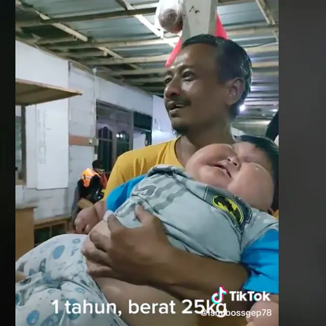 Viral bayi 1 tahun miliki berat badan 25 kg