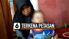 LEPAS PENGAWASAN ORANGTUA, BALITA TERBAKAR TERKENA PETASAN