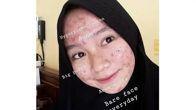 Percaya Diri Unggah Foto Berjawat di Medsos, Perempuan Ini Viral dan Menginspirasi