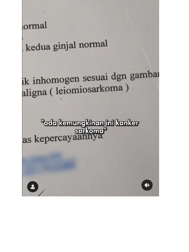 12 Potret Kondisi Alice Norin Usai Divonis Kanker Sarkoma, Terpaksa Menopause Dini