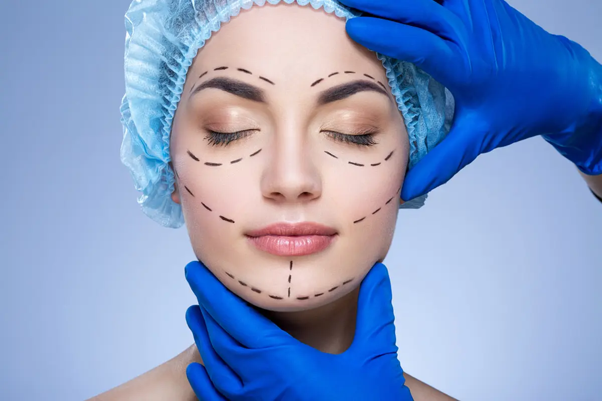 Cantik Luar Dalam dengan Operasi Plastik