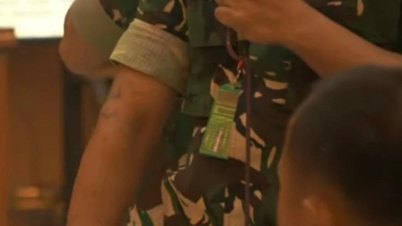 Momen Dua Prajurit TNI Tunjukan Luka Terciprat Air Keras Usai Siram Andrie Yunus, Ada Luka Hitam di Tangan hingga Dada