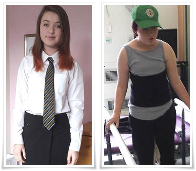 Rachel sebelum dan sesudah mengalami koma | Photo: Copyright dailymail.co.uk