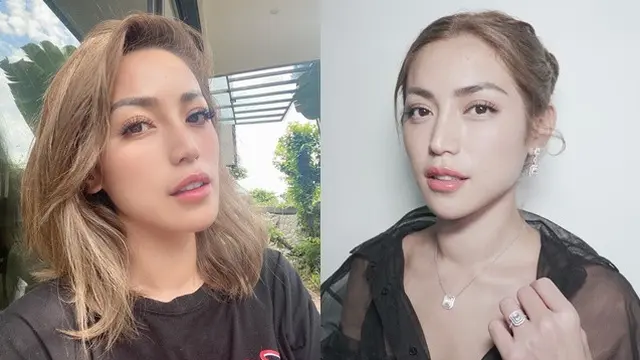 6 Potret Terbaru Jessica Iskandar, Leher Bengkak Akibat Sakit Tiroid