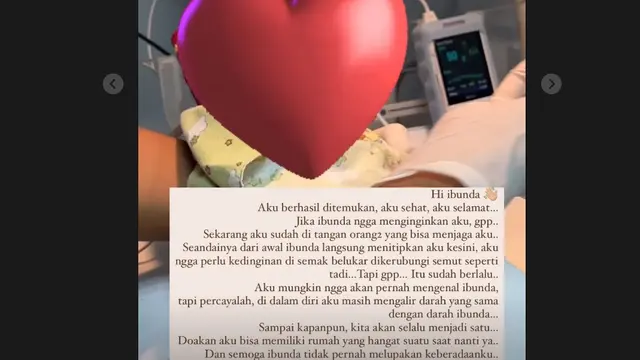 ART Nana Mirdad Temukan Bayi di Semak-Semak, Kaki Mulai Membiru dan Alami Hipotermia