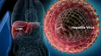 Menderita hepatitis C bukan hanya memengaruhi fisik tapi juga mengganggu kesehatan mental