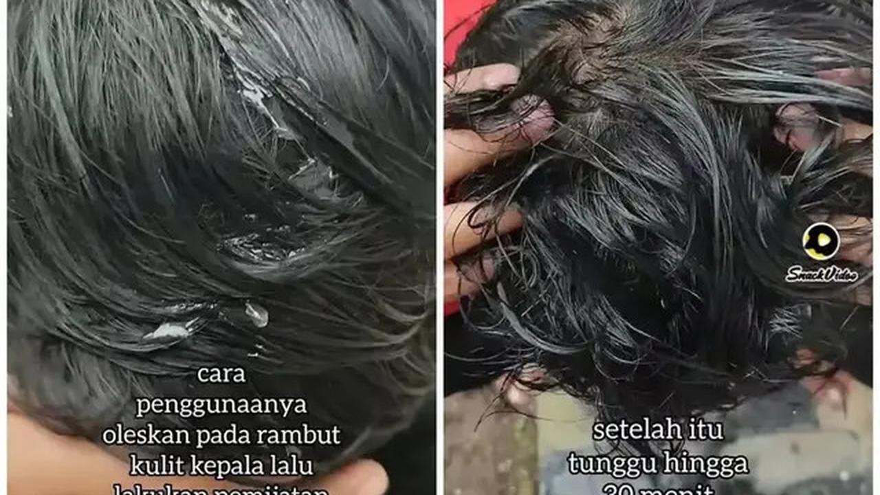 Cara Menumbuhkan Rambut Rontok Secara Alami, Cukup Gunakan 2 Bahan