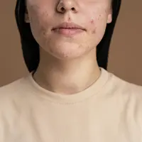 ilustrasi breakout wajah/copyright freepik/freepik