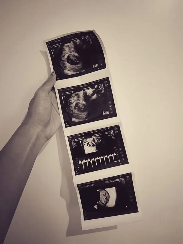 [Fimela] Audi Marissa dan Anthony Xie